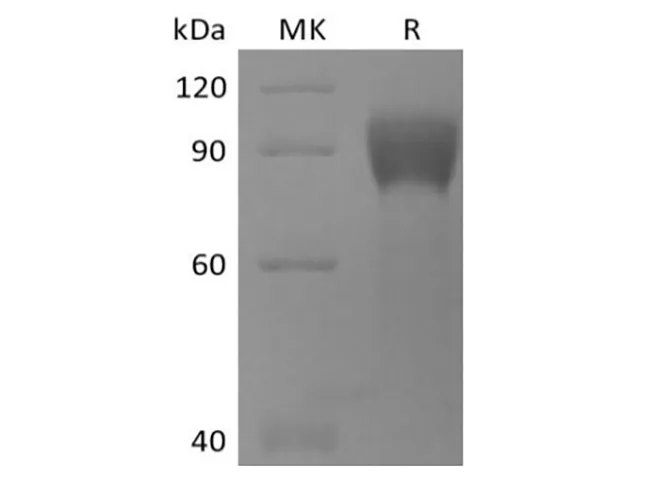 Recombinant Human TPBG/5T4 (C-mFc) - image 1