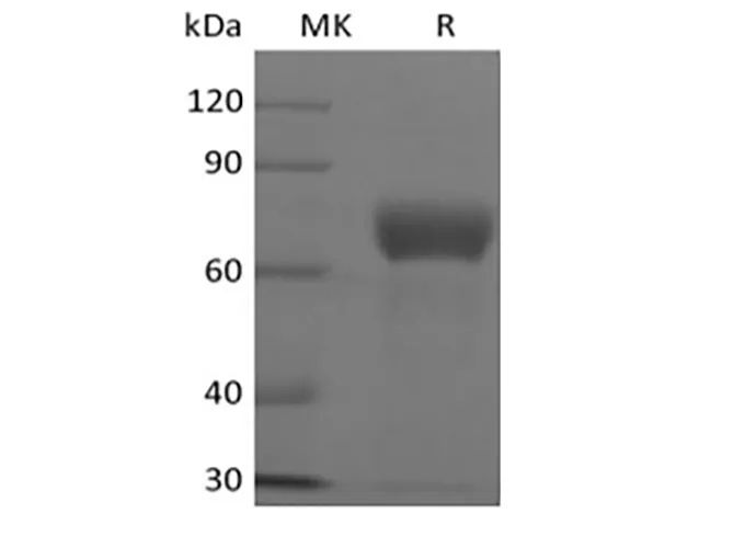 Recombinant Human TSLP R/CRLF2 (C-Fc) - image 1