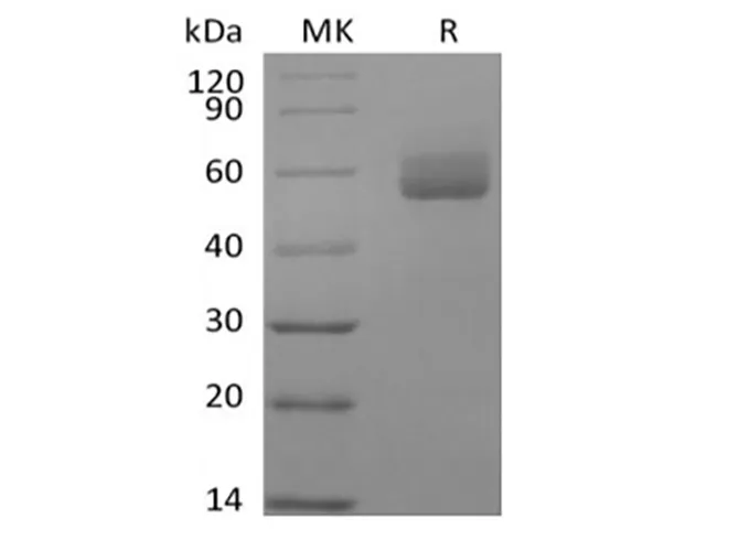 Recombinant Human GPIHBP1 (C-Fc) - image 1