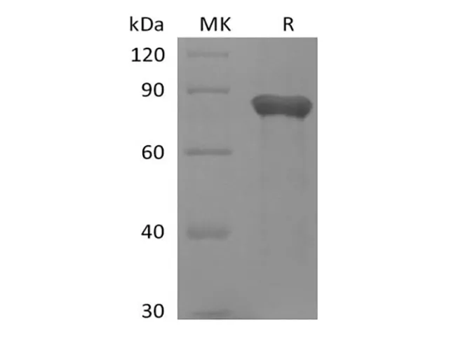 Recombinant Human GAS6 (C-6His) - image 1