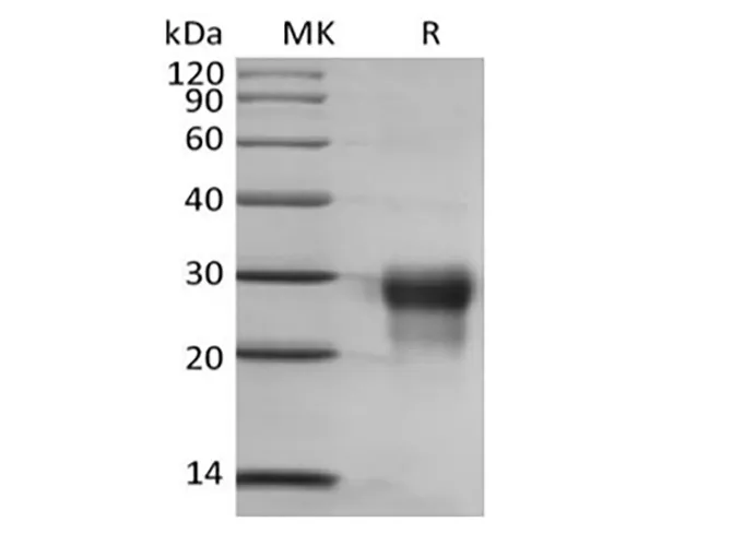 Recombinant Human Placenta Growth Factor/PGF/PIGF/PLGF (C-6His) - image 1