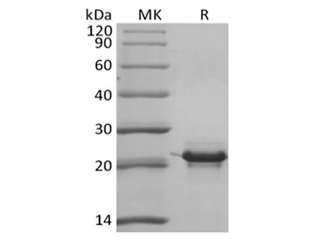 Recombinant Human KRAS4B (N-6His) - image 1