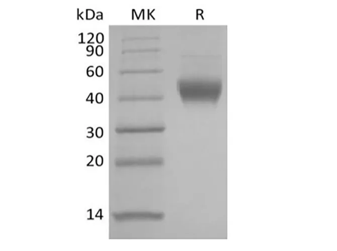 Recombinant Human IL-7 Receptor Subunit alpha/IL-7RA/CD127 (C-6His) - image 1