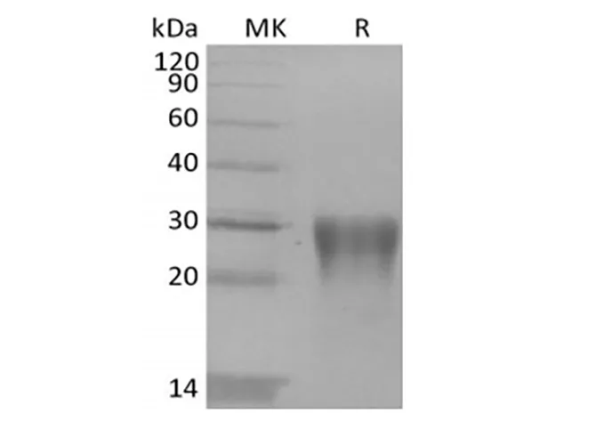 Recombinant Human Transforming Growth Factor Beta-1/TGFB1 - image 1