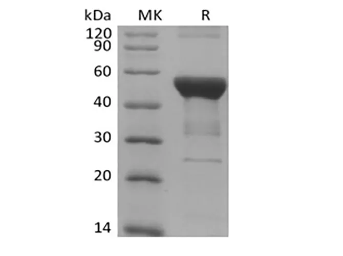 Recombinant Human NFKB1 (N-6His) - image 1