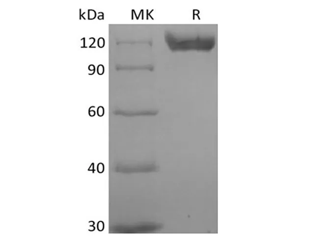 Recombinant Human B-cell Receptor CD22/Siglec-2/CD22 (C-6His) Biotinylated - image 1
