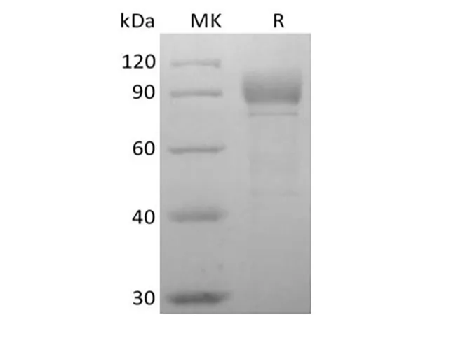 Recombinant Human Otolin-1 (C-6His) - image 1