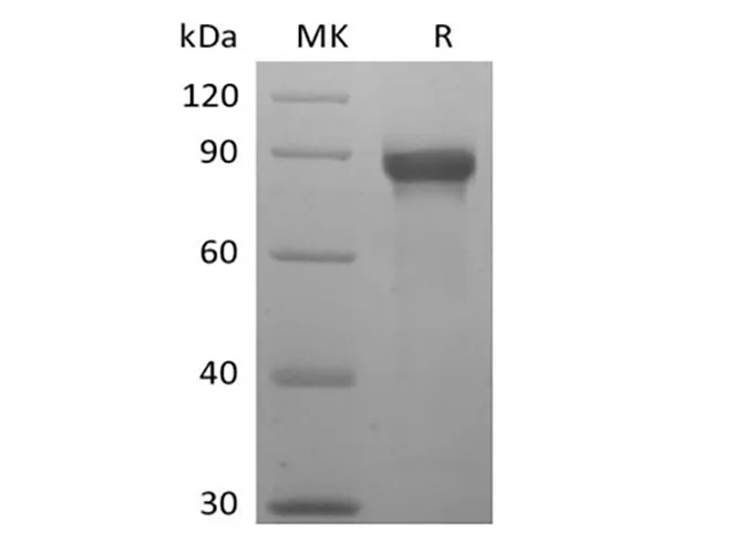 Recombinant Human Siglec-8 (C-mFc) - image 1