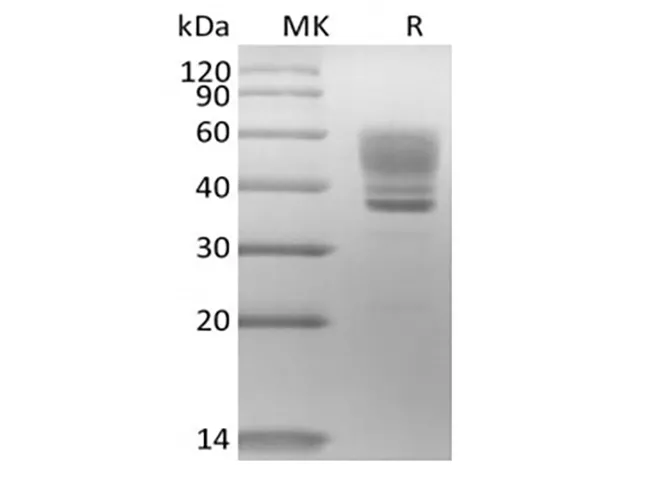 Recombinant Human Interleukin-13/IL-13 (C-mFc) - image 1