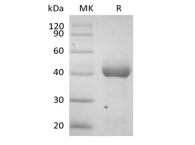Recombinant Human Activin RIA/ALK-2 (C-Fc) - image 1