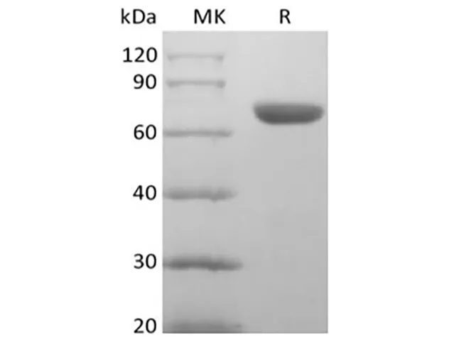 Recombinant Human EphA8 (C-6His) - image 1