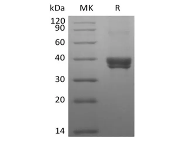 Recombinant Human DC-SIGNR/CD299 (N-8His-Flag) - image 1