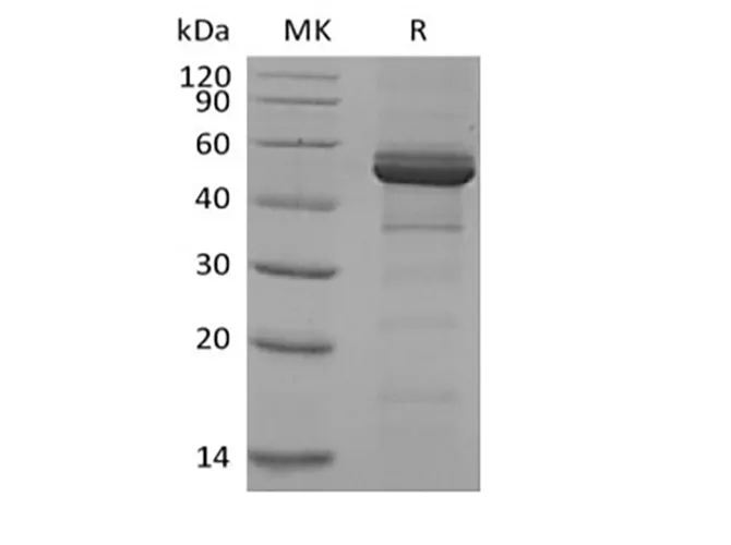 Recombinant Human TACI/TNFRSF13B/CD267 (C-Fc) - image 1