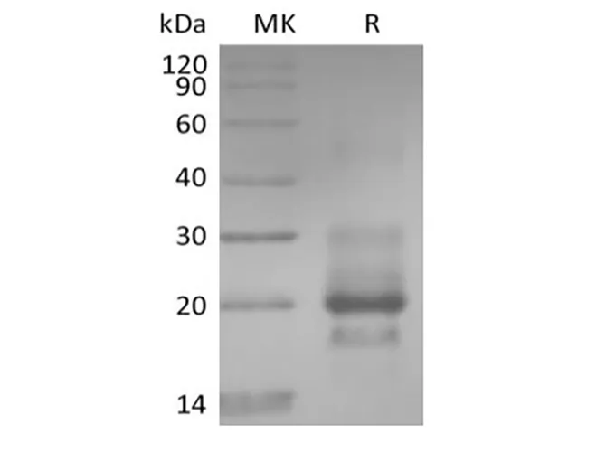 Recombinant Human TRAIL R1 / DR4 / TNFRSF10A (C-6His) - image 1