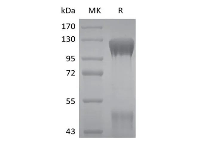 Recombinant Human IGF-I R/IGF1R (C-6His) - image 1