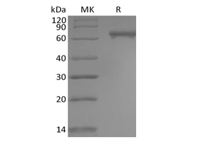 Recombinant Human Notch2 (C-6His) - image 1