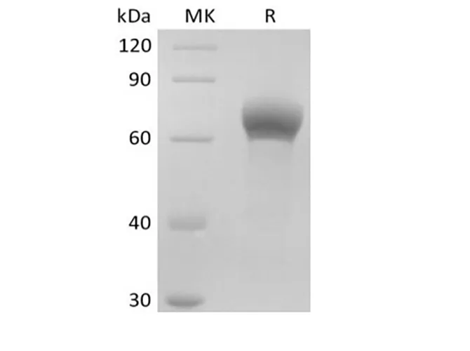 Recombinant Human Dickkopf-Related Protein 1/DKK-1 (C-Fc) - image 1