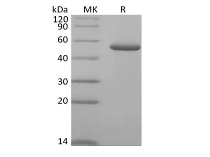 Recombinant Human RCN2 (C-6His) - image 1