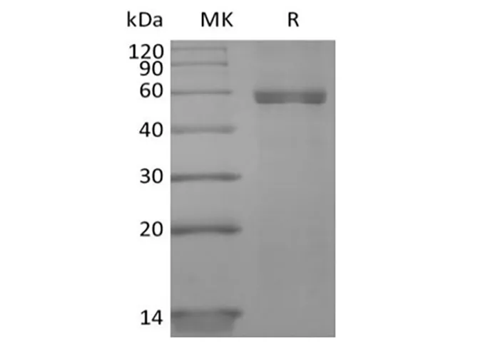 Recombinant Human HLA-A*0201 NY-ESO-1 complex Protein (C-10His) - image 1