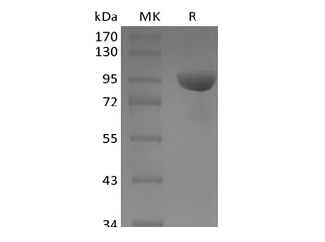 Recombinant Human Ephrin B Receptor 1/EphB1 (C-Fc) - image 1