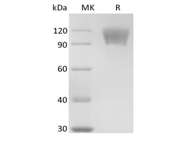 Recombinant Human TNFRSF8/CD30L Receptor/CD30 (C-mFc) - image 1