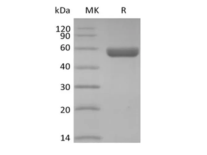 Recombinant Human HLA-A*0201 GP100 complex Protein (C-10His) - image 1