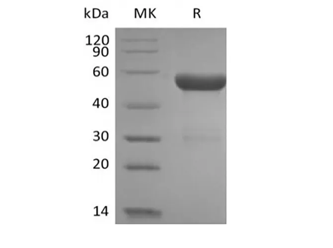 Recombinant Human HLA-A*0201 HPV16 E7 complex Protein (C-10His) - image 1
