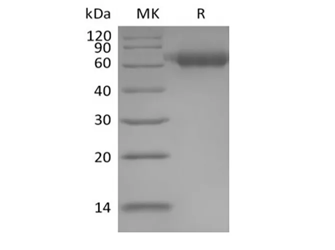 Recombinant Human IL-1 Receptor Accessory Protein/IL-1RAcP/IL-1R3 (C-6His) - image 1