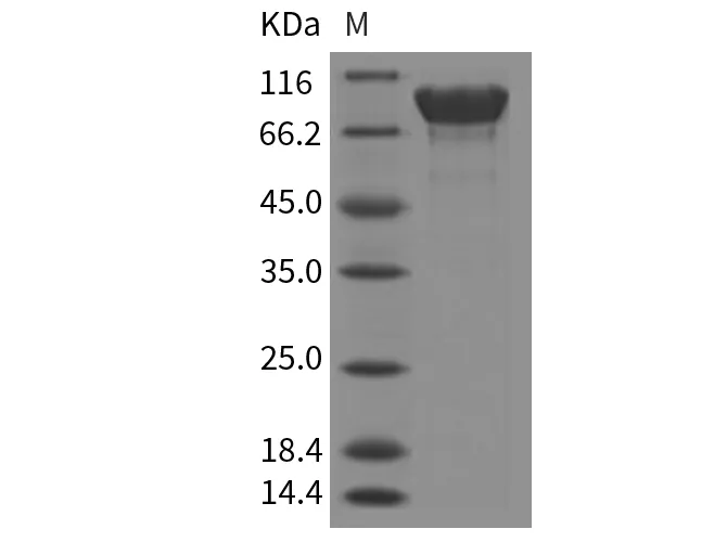 Recombinant Mouse APLP1/Amyloid-like Protein (His Tag) - image 1