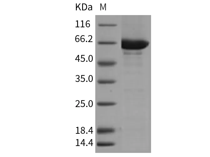 Recombinant Mouse CSK/C-Src kinase Protein (His & GST Tag) - image 1
