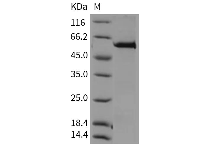 Recombinant Mouse MERTK/MER Protein (His & GST Tag) - image 1