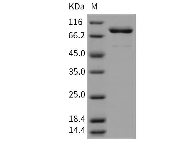 Recombinant Mouse SRC Kinase/c-SRC Protein (His & GST Tag) - image 1