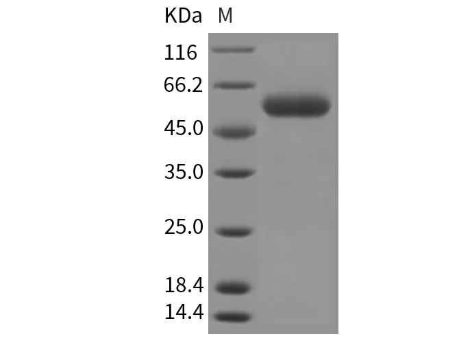 Recombinant Mouse SCPEP1/RISC Protein (His Tag) - image 1