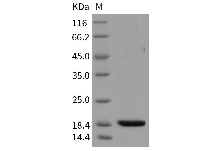 Recombinant Mouse REG3B/Pap1 Protein (His Tag) - image 1