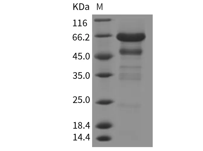 Recombinant Mouse IGFBP-2/IGFBP2 Protein (Fc Tag) - image 1
