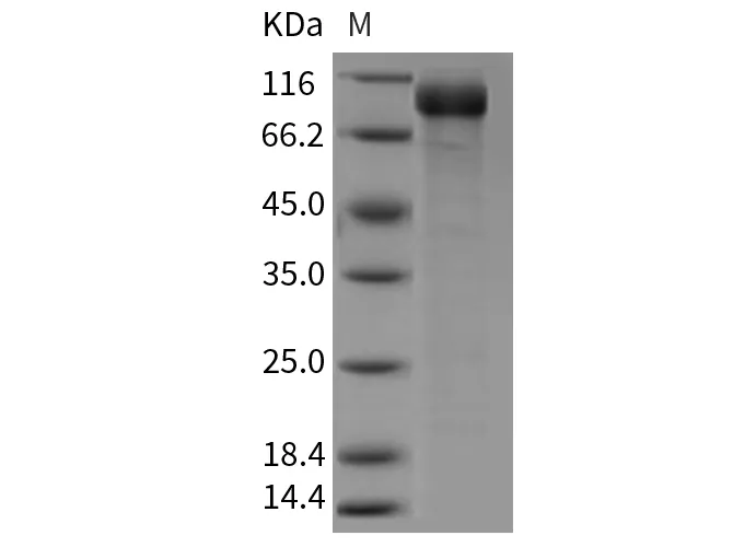 Recombinant Mouse Semaphorin 5A/SEMA5A Protein (His Tag) - image 1