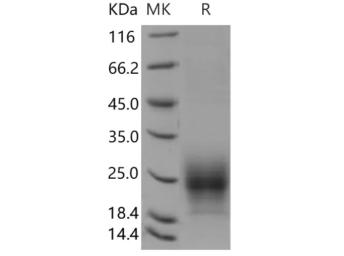 Recombinant Mouse TIGIT Protein (His Tag) - image 1