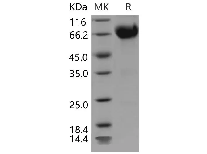Recombinant Mouse IL10RB/IL10R2 Protein (Fc Tag) - image 1