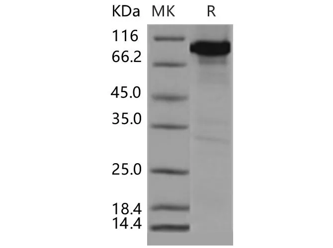 Recombinant Mouse CAMK4/CaMKIV Protein (His & GST Tag) - image 1