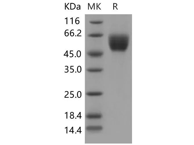 Recombinant Mouse SIRPB1A/SIRP beta 1 Protein (His Tag) - image 1