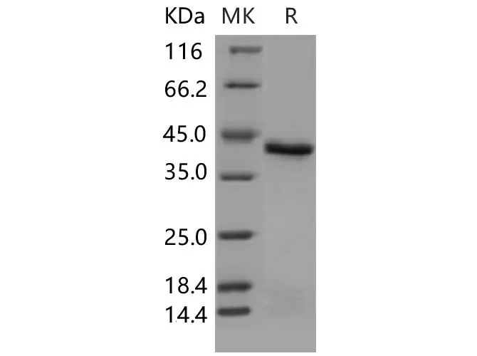 Recombinant Mouse PTPN2/PTPT Protein (aa 2-314, His Tag) - image 1