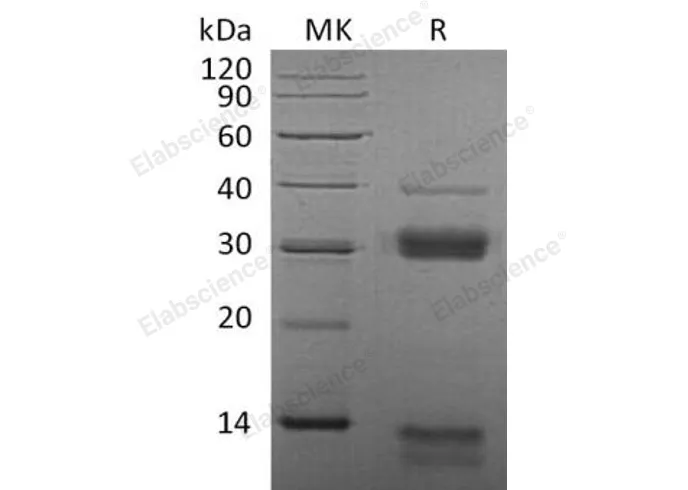 Recombinant Mouse Cathepsin S/CTSS Protein (His Tag) - image 1