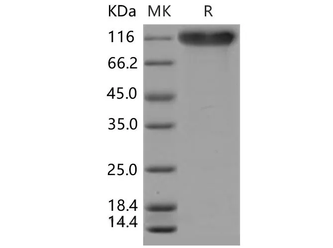 Recombinant Mouse SELP/selectin P/P-selectin Protein (His Tag) - image 1