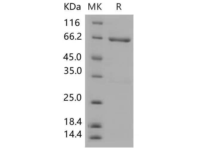 Recombinant Mouse MEK4/MAP2K4 Protein (His & GST Tag) - image 1