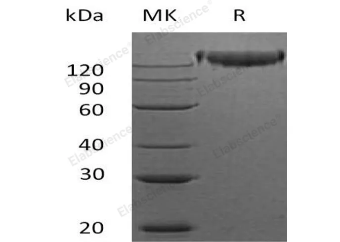 Recombinant Mouse Semaphorin-4D/SEMA4D Protein (His Tag) - image 1