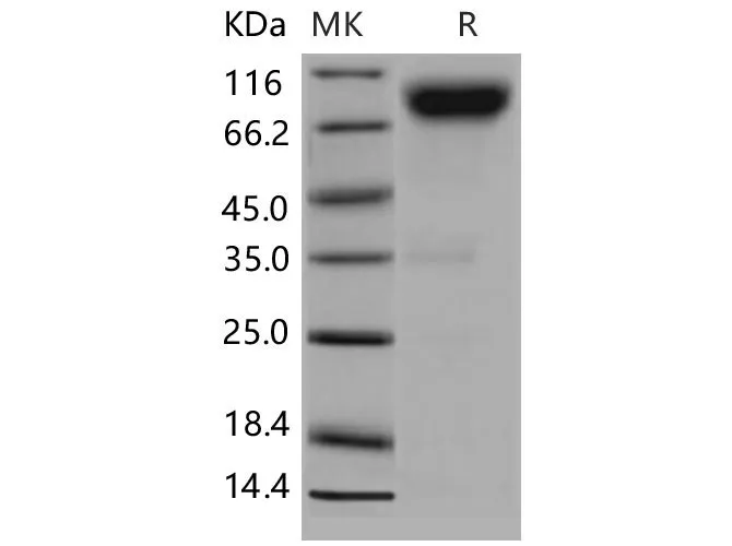 Recombinant Mouse CD200R4/CD200RLa Protein (Fc Tag) - image 1