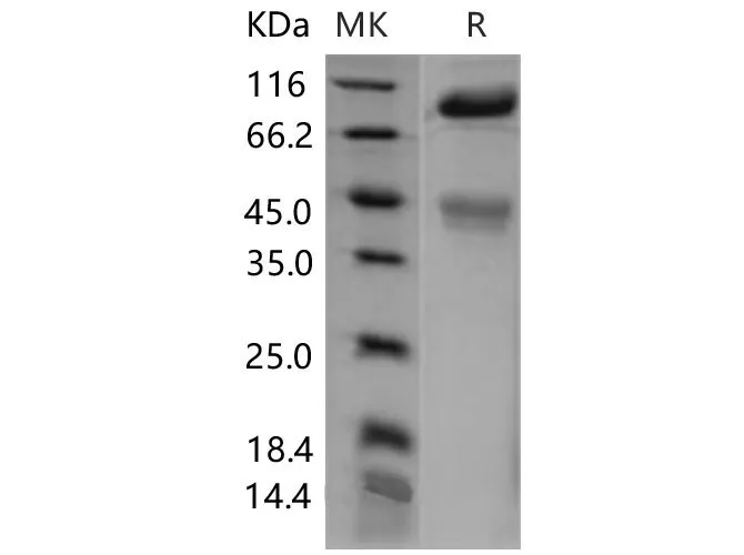 Recombinant Mouse c-MET/HGFR Protein (His Tag) - image 1