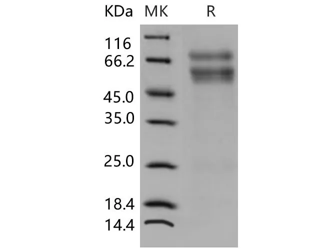 Recombinant Mouse CHST3/C6ST-1 Protein (His Tag) - image 1