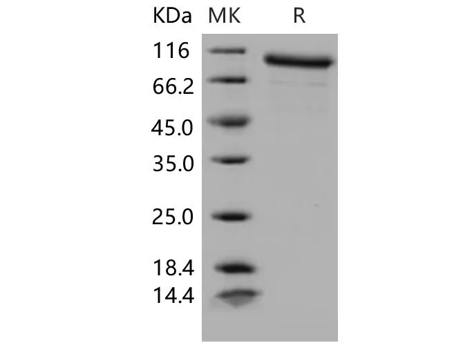 Recombinant Mouse MMP-9 Protein - image 1