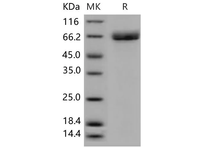 Recombinant Mouse Acetylcholinesterase/ACHE Protein (His Tag) - image 1
